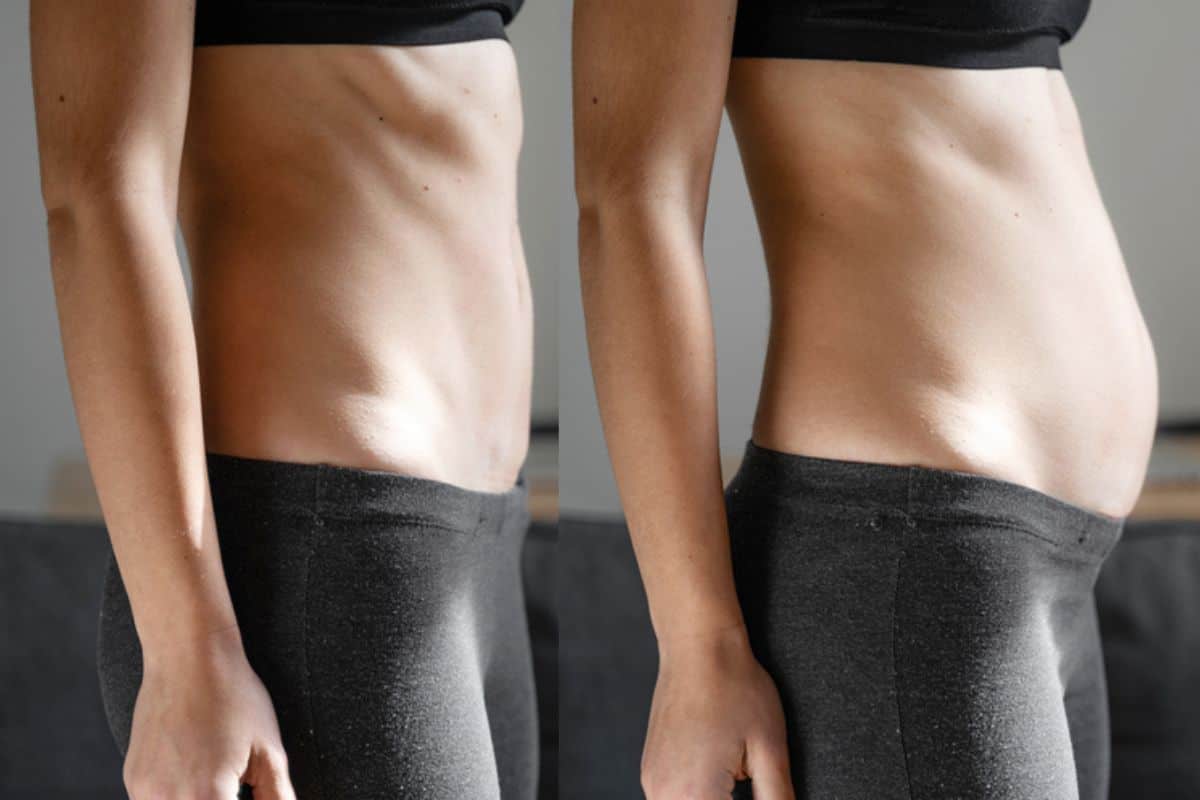 How long does diastasis recti take to improve Uxbridge Moor?