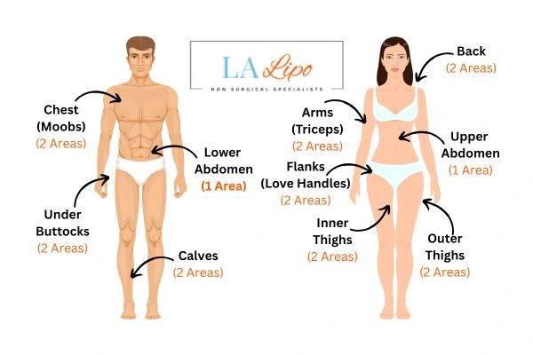 LA LIPO Cryolipolysis Areas Uxbridge Moor