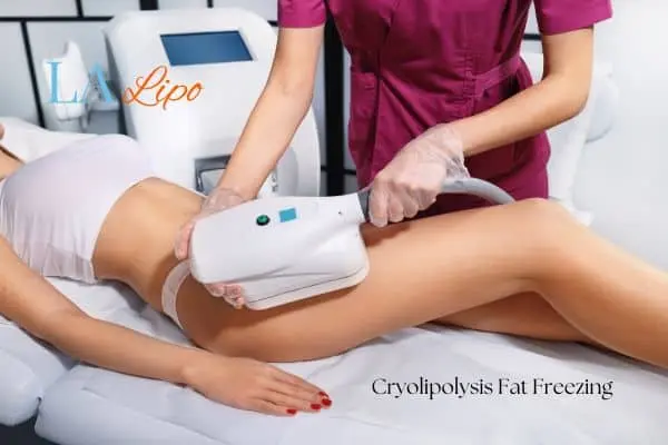 Woman receiving coolsculpting Uxbridge Moor treatment on her thighs