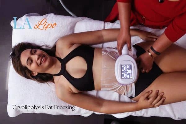 woman getting cryolipolysis Uxbridge Moor