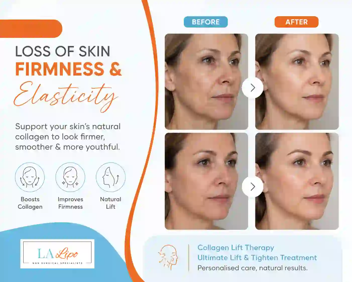 Sign #7: Loss of Skin Firmness and Elasticity Uxbridge Moor